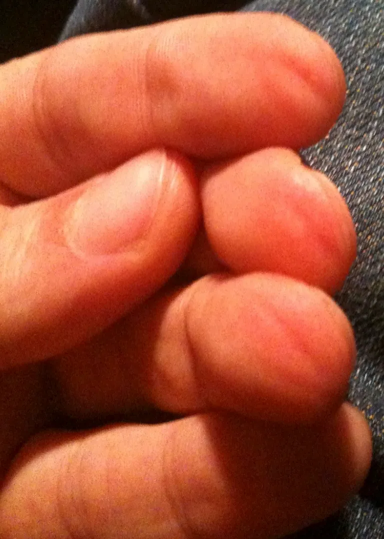 Réglage cordes guitare pour moins de douleur