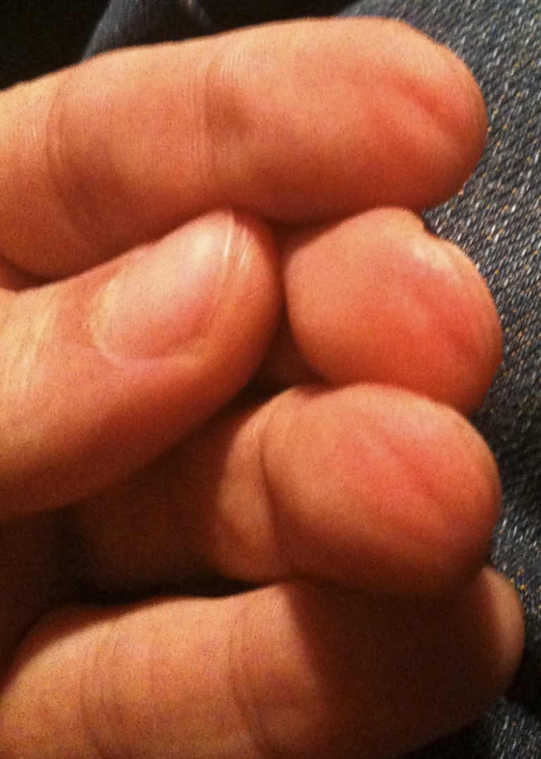 Réglage cordes guitare pour moins de douleur